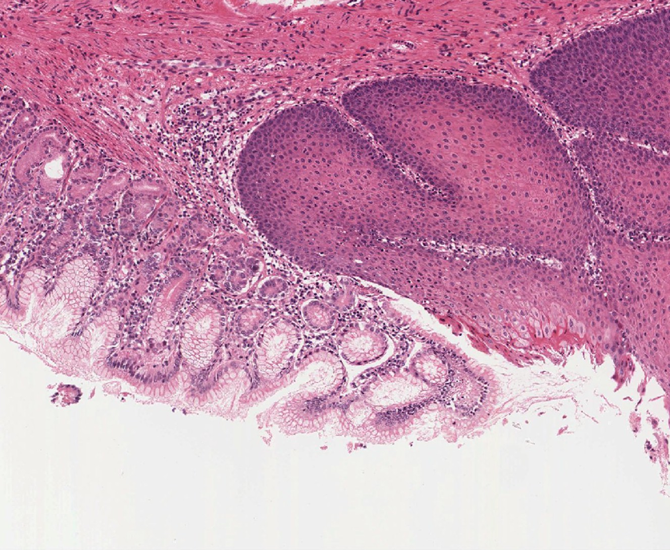 Histology Of The Esophagus And Stomach